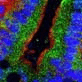 Darmzellen unter Mikroskop