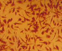 Als Zeichen einer Entzündung sind Makrophagen im Fettgewebe zu finden