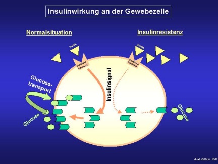 Diabetes Typ 2: Was kommt nach der Diagnose auf mich